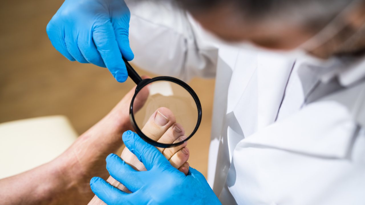 Podiatrist examining a patient's toe for an ingrown toenail